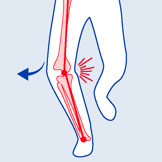 BiomechanicalDeficits-VarusMovement